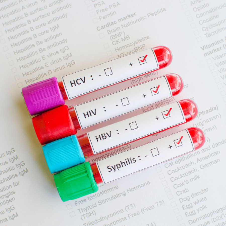 STI tests